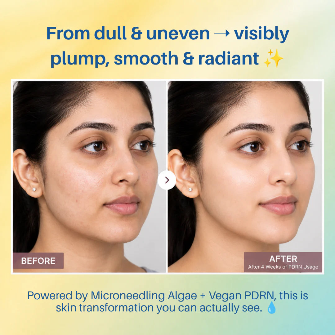 Aegte Hylu-Collagen Advanced Skin Booster With Microneedling Algae & Vegan PDRN