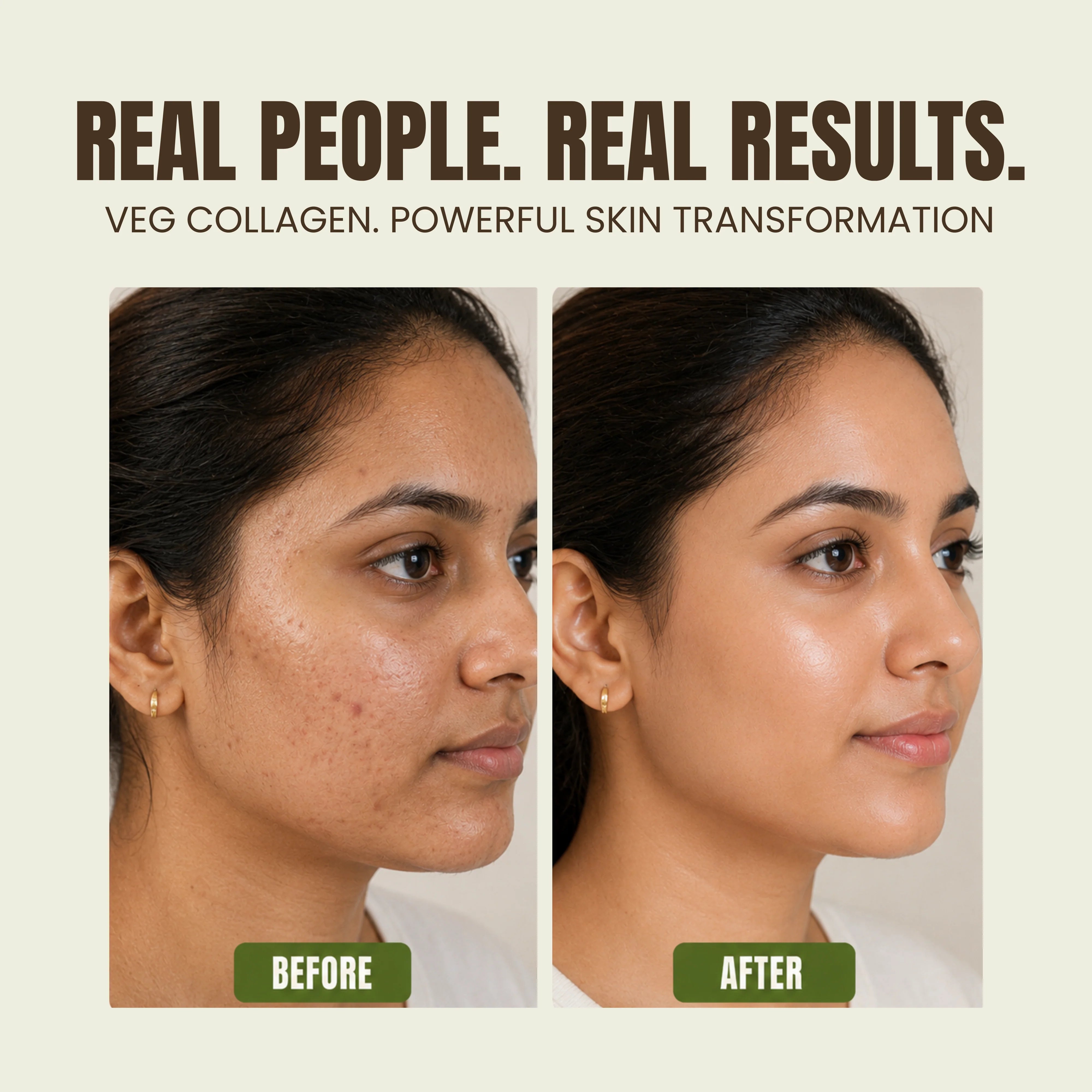 Aegte Hylu-Collagen Advanced Skin Booster With Microneedling Algae & Vegan PDRN